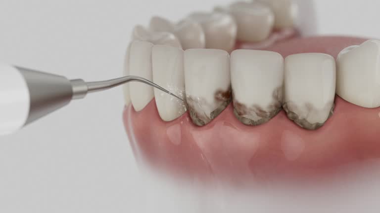 Trusted Dental Implants service in Lake Isabella, MI - Dentist Open Now